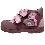 Kép 1/3 - madarkas,lany,supinalt