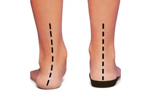 Supinált szandálok bentre és kintre